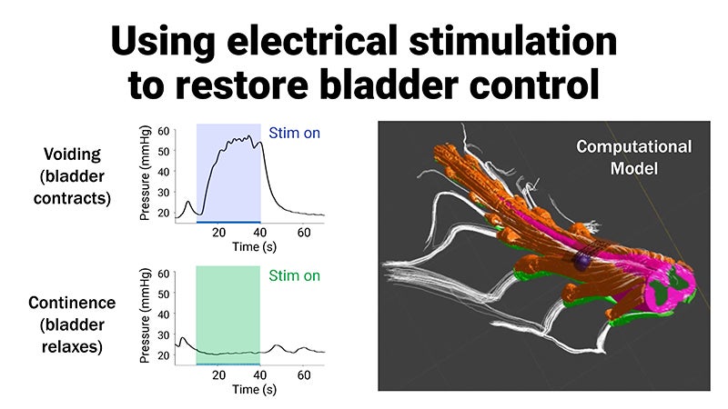 3MT Presentation Slide: Using Electrical Stimulation to Restore Bladder Control